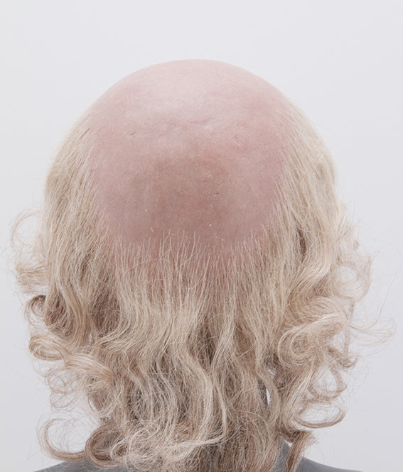 Atelier Bassi LENGAR Silicone Bald Wig With Fringe Of Hair