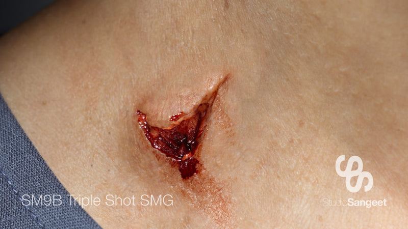 STUDIO SANGEET - TRAUMA FLAT MOULD - Triple Shot SMG