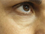 STUDIO SANGEET - Skin Seconds - Eyebags